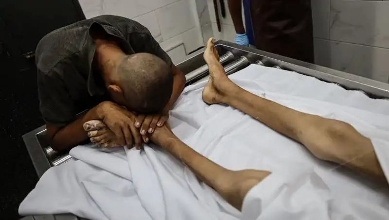 Gazze'de Açlık Felaketi: Bir Çocuğun Daha Hayata Veda Etmesi