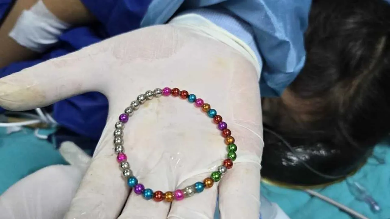 5 Yaşındaki Çocuğun Bağırsağından 38 Mıknatıs Çıkarıldı: Doktorlardan Uyarı