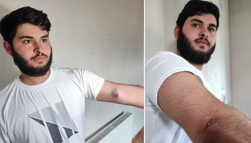 Bahçeye Kaçan Top, Mahallede Geniş Kargaşaya Neden Oldu!